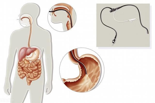 探秘神秘胃镜馆，不插管胃镜体验新探秘
