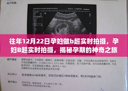 揭秘孕期神奇之旅，孕妇B超实时拍摄记录，以12月22日为例的独特观察体验