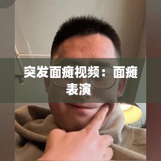 突发面瘫视频：面瘫表演 