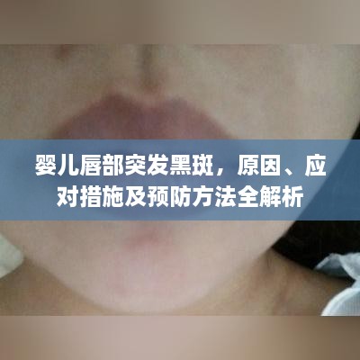 婴儿唇部突发黑斑，原因、应对措施及预防方法全解析