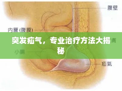 突发疝气，专业治疗方法大揭秘