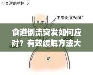 食道倒流突发如何应对？有效缓解方法大揭秘