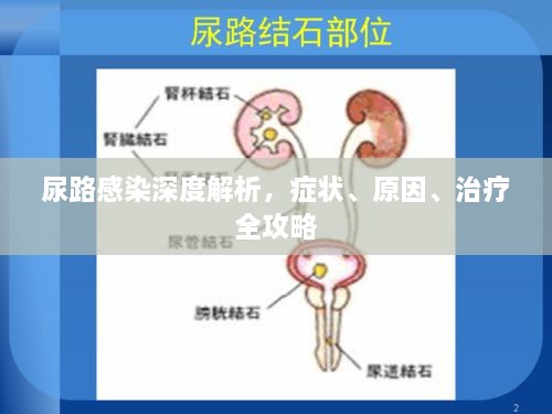 尿路感染深度解析，症状、原因、治疗全攻略