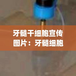 牙髓干细胞宣传图片：牙髓细胞和牙髓干细胞区别 