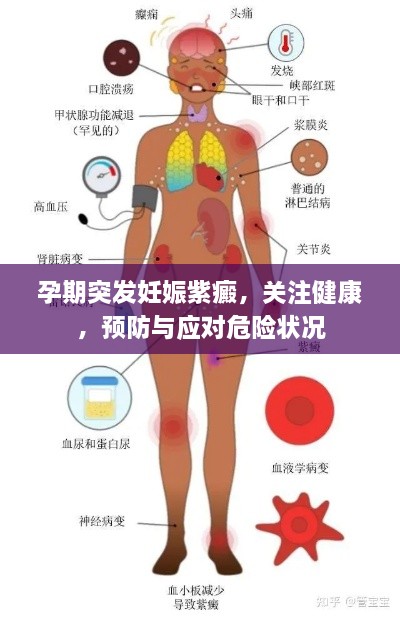 孕期突发妊娠紫癜，关注健康，预防与应对危险状况